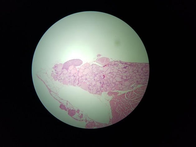 Parathyroid Thyroid Slides - Parathyroid_Thyroid 002 40X